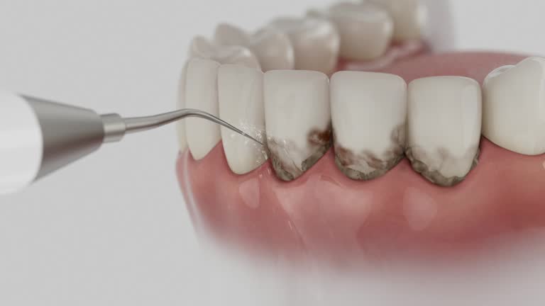 Trusted Invisalign Clear Aligners service in Wamac, IL - Dentist Open Now